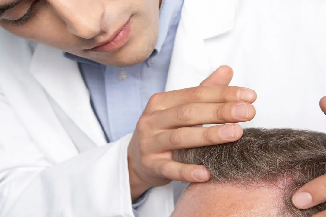 Always consult your doctor about the right brand and type of shampoo.