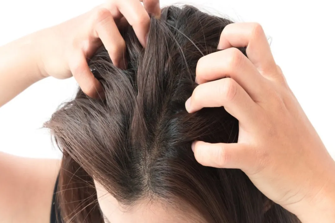 If you have sensitive skin, use mild shampoos without harsh chemicals.